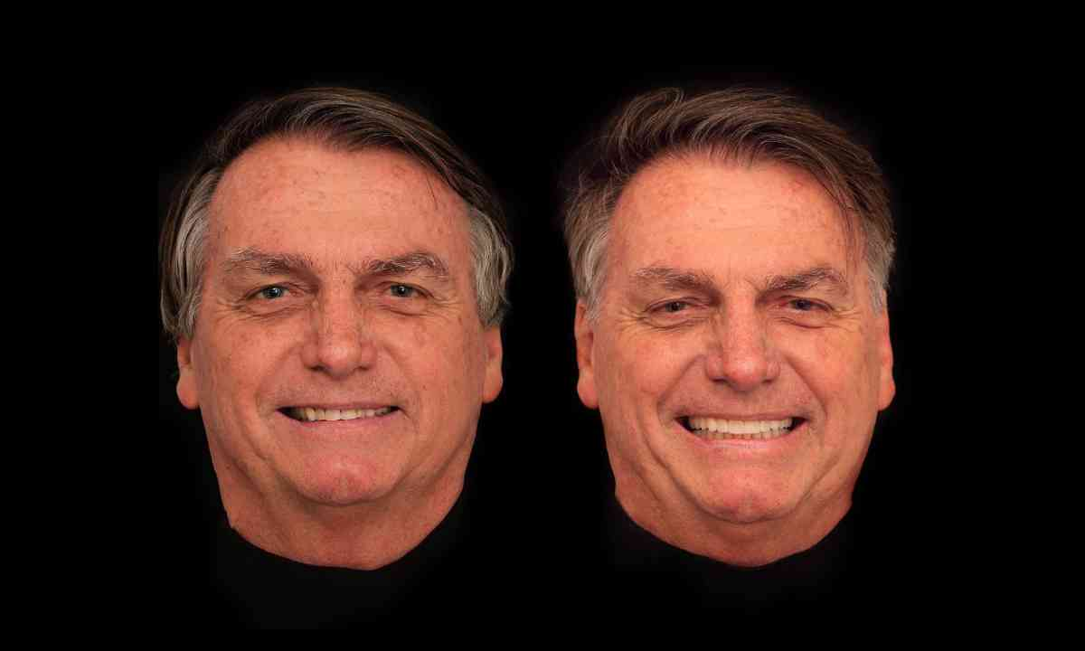 Bolsonaro gasta R$ 84 mil em harmonização facial e dentária  
