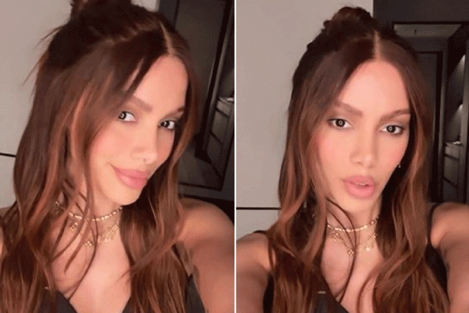 O que Anitta fez no rosto? Especialistas desvendam o que está por de trás da mudança facial da cantora -  (crédito: Reprodução/Redes sociais )