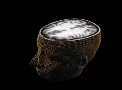 As conexões identificadas estão em áreas mais profundas do cérebro, como o cerebelo - (crédito: AFP) As conexões identificadas estão em áreas mais profundas do cérebro, como o cerebelo - (crédito: AFP)
