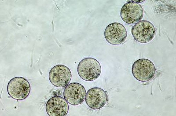 Crédito: Genome Research Limited / Divulgação. Imagem de um processo de fertilização in vitro.