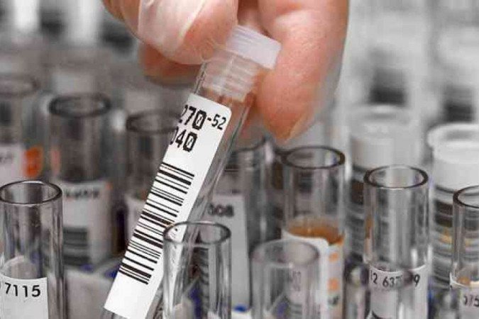  (crédito: Divulgação/Roche)