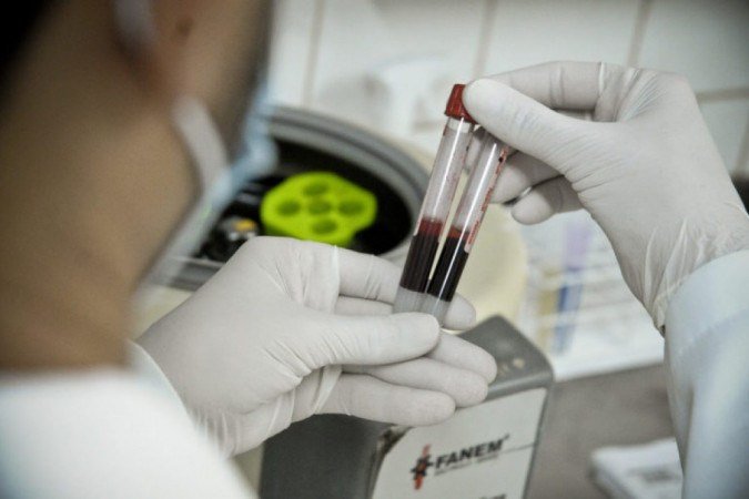 DF é a unidade da federação que mais testou pessoas para o coronavírus no país - (foto: Foto: Breno Esaki/Agência Saúde DF) DF é a unidade da federação que mais testou pessoas para o coronavírus no país - (foto: Foto: Breno Esaki/Agência Saúde DF)