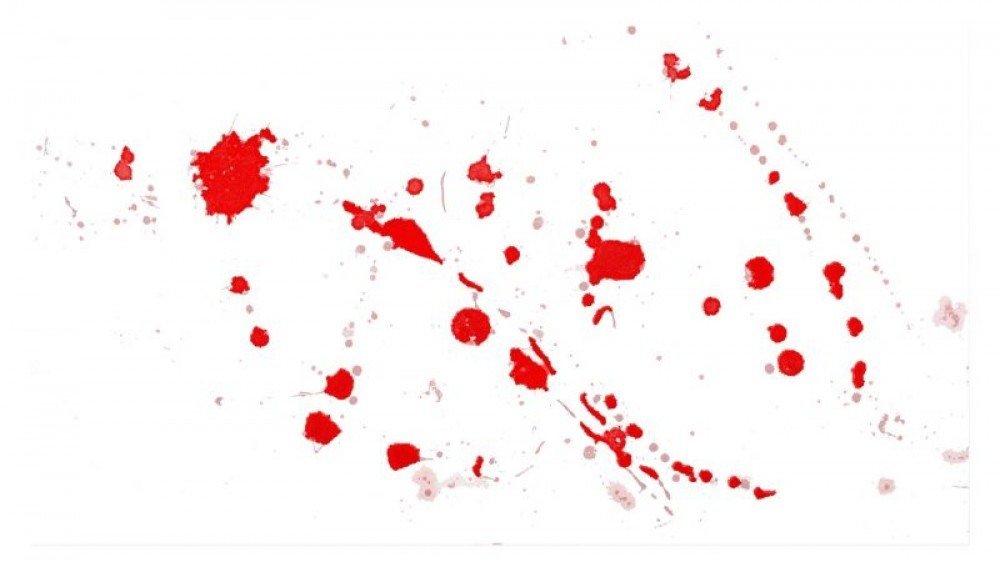 Garotas de programa são esfaqueadas na W3 Norte