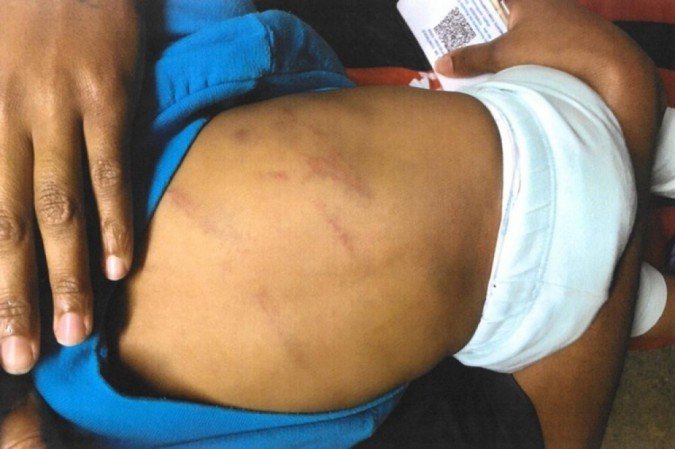  (crédito: Divulgação / PCDF)