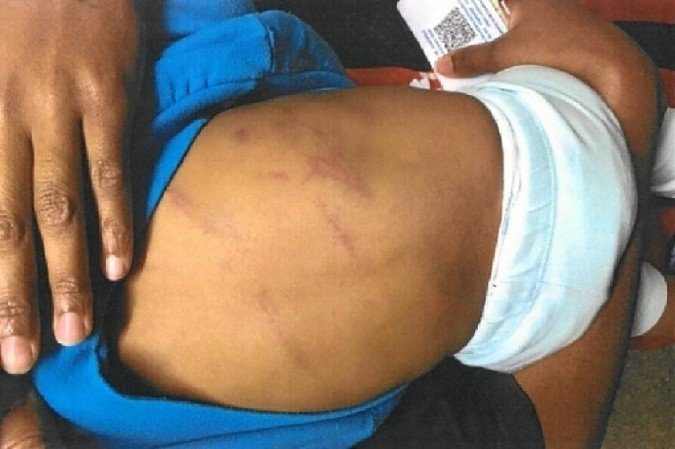 Segundo a polícia, a criança disse, em depoimento, que o padastro machucava a boca do bebê até sangrar -  (crédito: Polícia Civil/Divulgação)