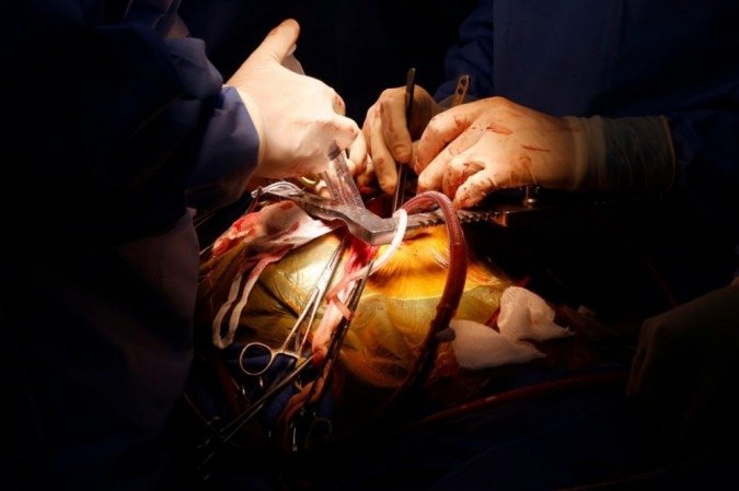 Objetivo da força-tarefa é reduzir filas de pacientes.