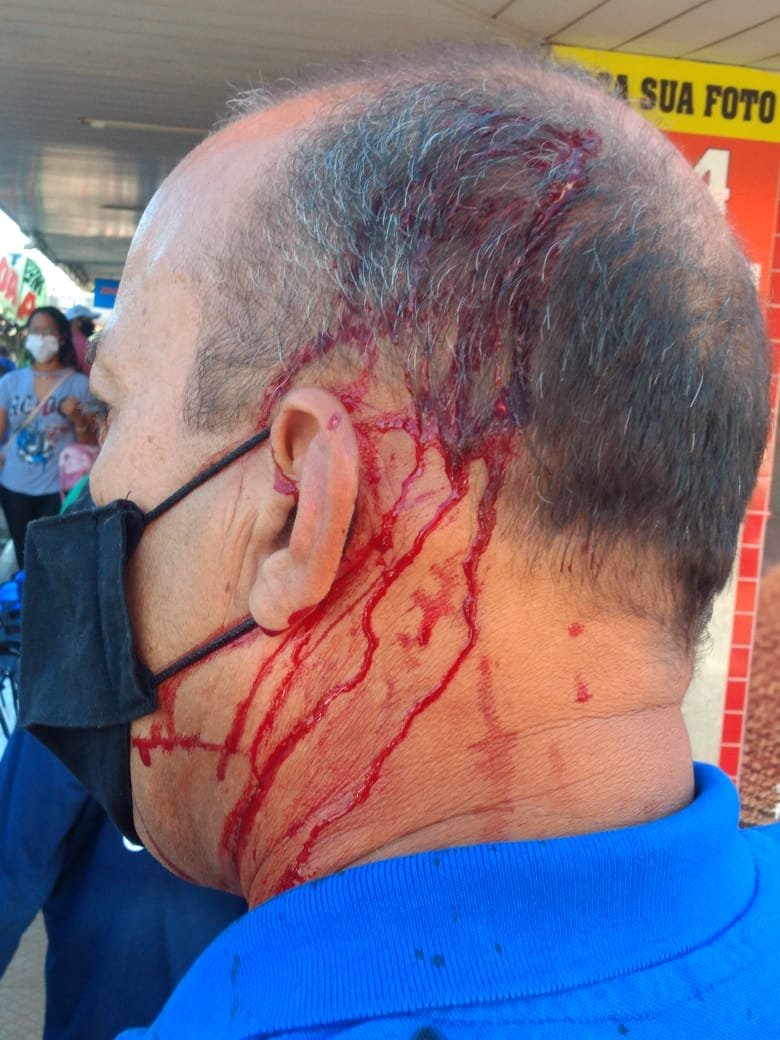 Servidor da DF Legal é atacado com cadeira por ambulante no Taguacenter