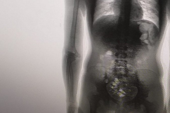  (crédito: SespMT/Divulgação)