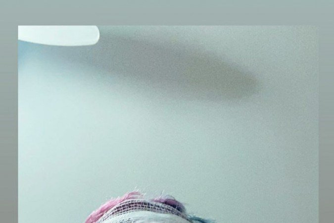 Foto de Mc Brinquedo após acidente de moto