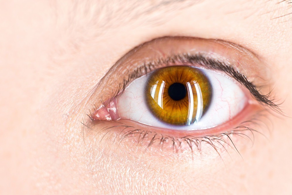 Sete em dez oftalmologistas relatam alta de miopia em crianças e adolescentes