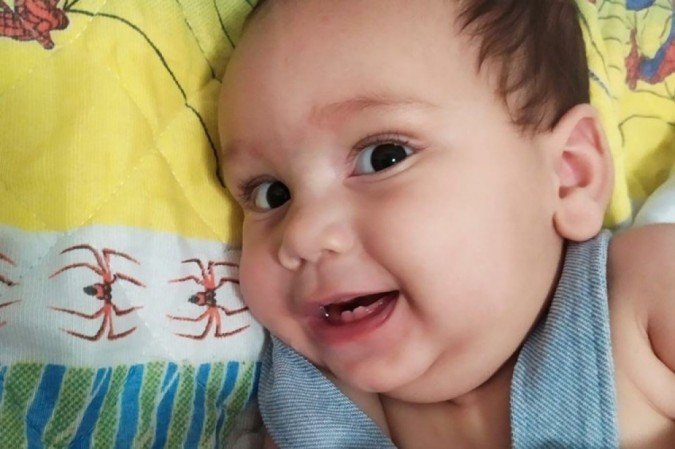 Gabriel está com 6 meses e não consegue sentar, além de tet dificuldades de respiração e deglutição - (crédito: Arquivo Pessoal) Gabriel está com 6 meses e não consegue sentar, além de tet dificuldades de respiração e deglutição - (crédito: Arquivo Pessoal)