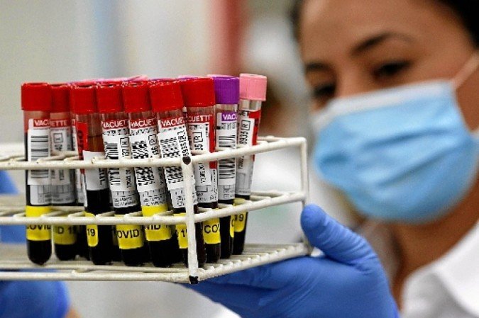 Quantidade de recuperados, até o momento, é de 208.668 — 96,2% do total de contaminados - (crédito: Gil Cohen-Magen/AFP) Quantidade de recuperados, até o momento, é de 208.668 — 96,2% do total de contaminados - (crédito: Gil Cohen-Magen/AFP)