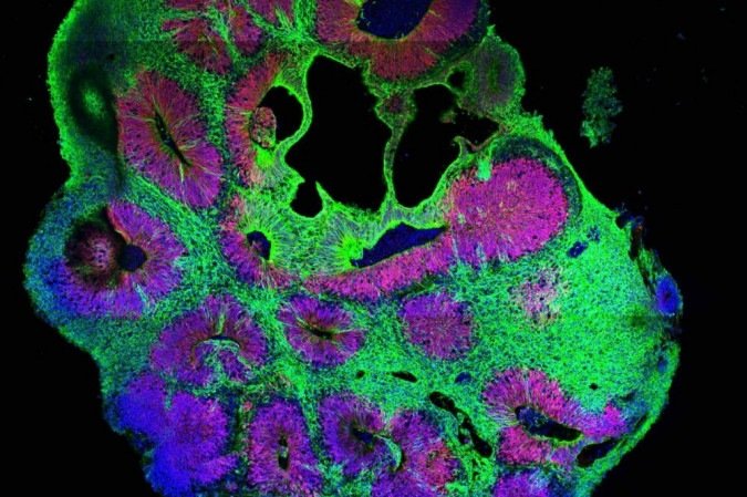 Imagem fluorescente de um organoide cerebral (modelo de cérebro criado em laboratório) usado no estudo -  (crédito: IMBA/Divulga&ccedil;&atilde;o)