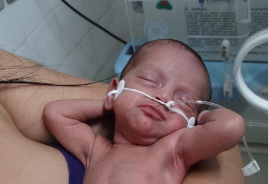 Ricardo Lamia/Hospital Regional de Ceilândia