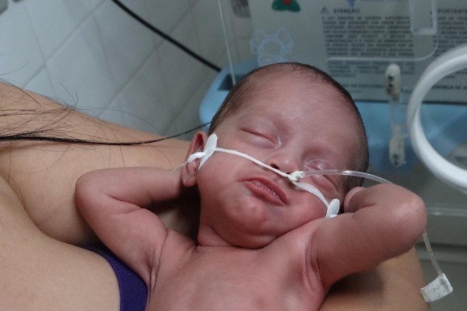      -  (crédito: Ricardo Lamia/Hospital Regional de Ceilândia)