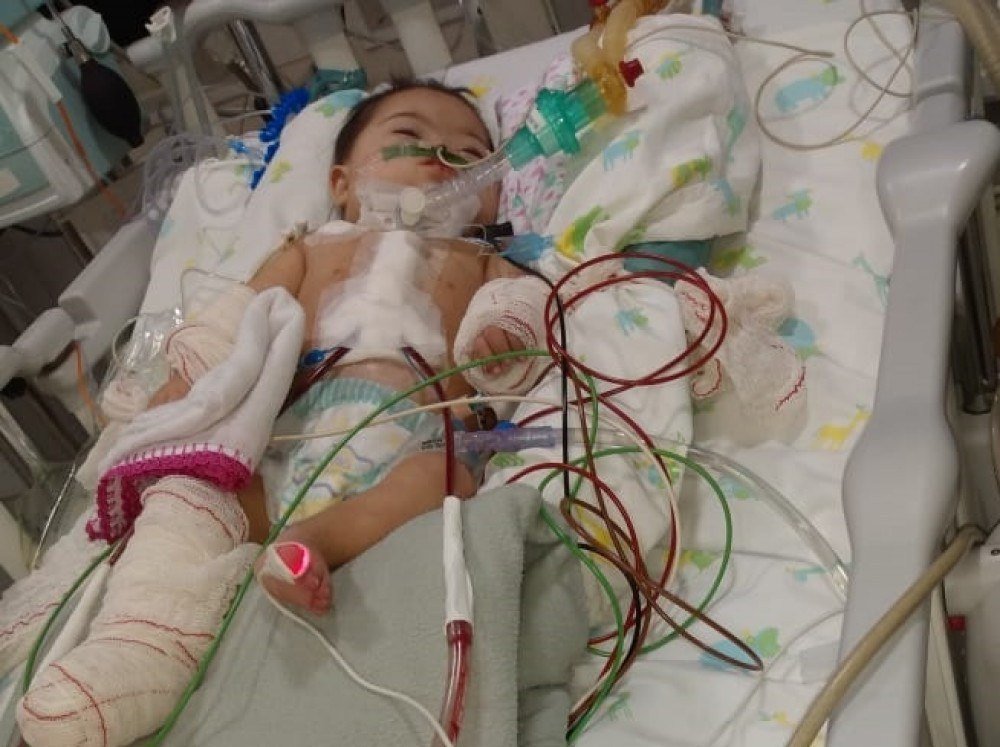 Bebê do DF passa por cirurgia no coração depois de quatro meses de espera