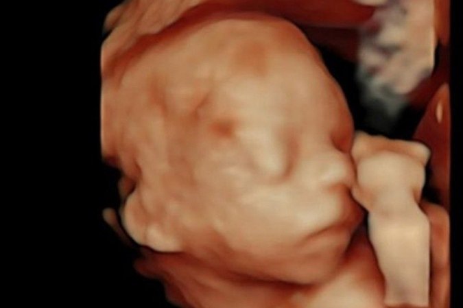  (crédito: Reprodução/Instagram)