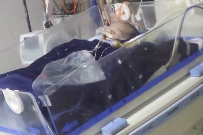 Khalleo Lucas teve complicações no pós-operatório e não resistiu - (crédito: Arquivo pessoal ) Khalleo Lucas teve complicações no pós-operatório e não resistiu - (crédito: Arquivo pessoal )
