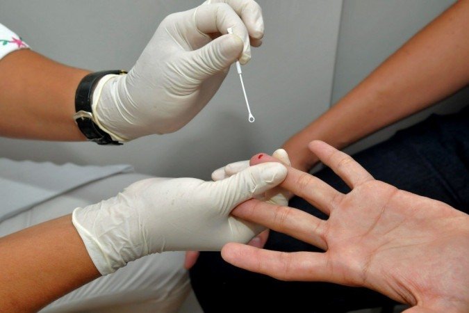 Rede pública de saúde oferece testes rápidos para detecção do HIV - (crédito: Marcelo Ferreira/CB) Rede pública de saúde oferece testes rápidos para detecção do HIV - (crédito: Marcelo Ferreira/CB)