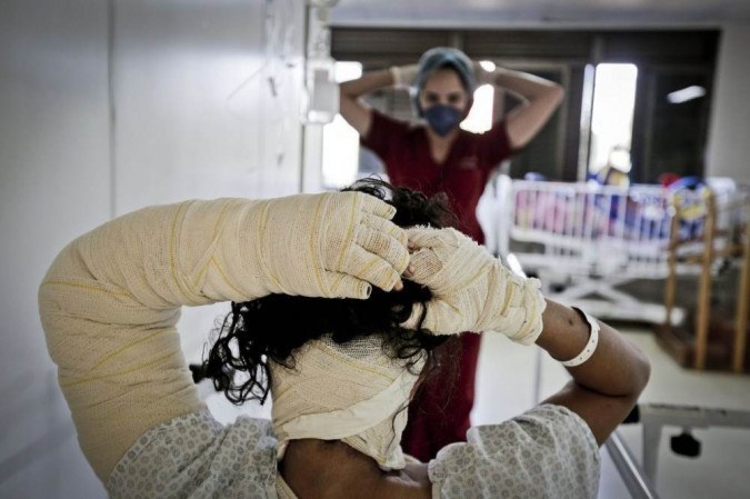 A unidade é referência no tratamento de queimados no Centro-Oeste - (crédito: Breno Esaki/Agência Saúde) A unidade é referência no tratamento de queimados no Centro-Oeste - (crédito: Breno Esaki/Agência Saúde)