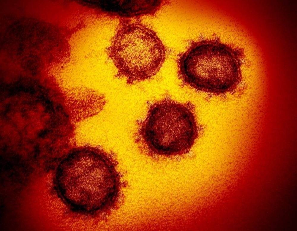 (crédito: AFP / National Institutes of Health / Handout) (crédito: AFP / National Institutes of Health / Handout)
