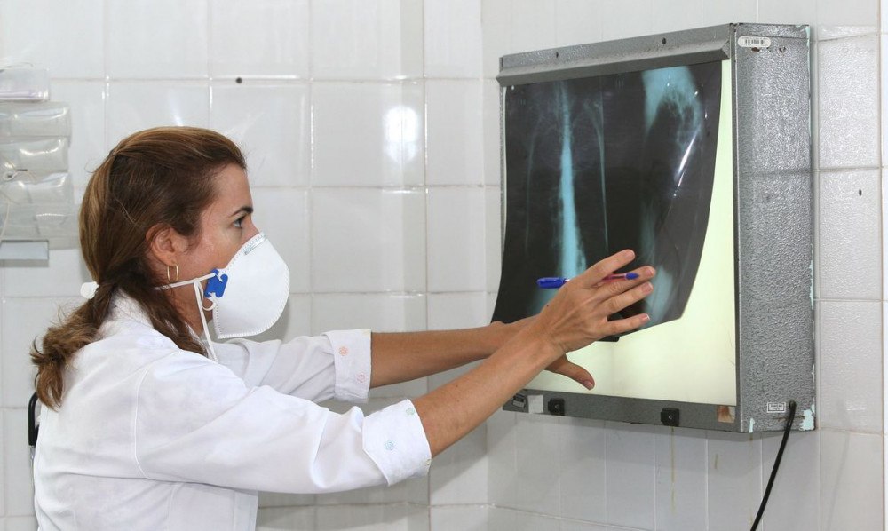 Pandemia reduz avanços no combate à tuberculose, diz especialista