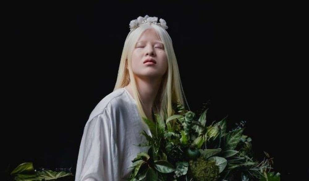 A chinesa albina abandonada bebê que se tornou modelo da Vogue