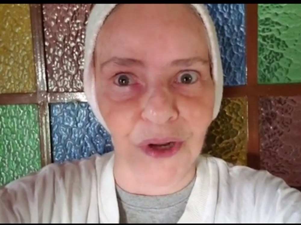 Cantora Angela Ro Ro leva quatro pontos na cabeça, após queda em casa