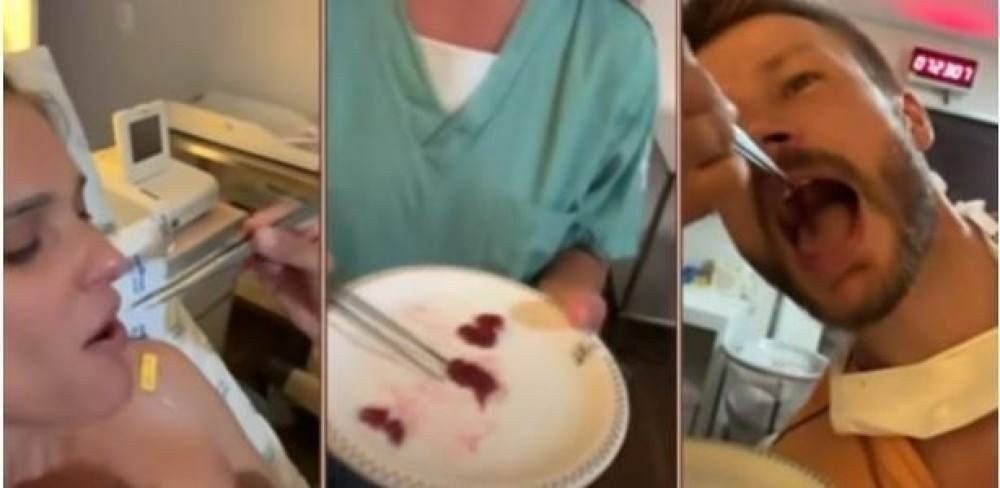 Fernanda Lima e Rodrigo Hilbert comeram a placenta após parto da filha