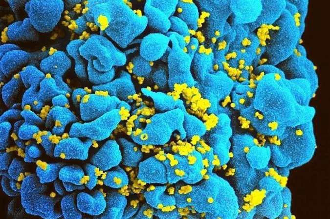  (crédito:  NIH/NIAID/Divulgação)