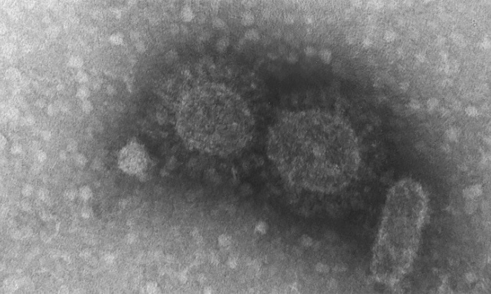 Maioria das doenças infecciosas tem origem em animais selvagens, diz estudo da UFRGS