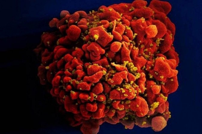 (crédito: Handout / National Institutes of Health / AFP) (crédito: Handout / National Institutes of Health / AFP)