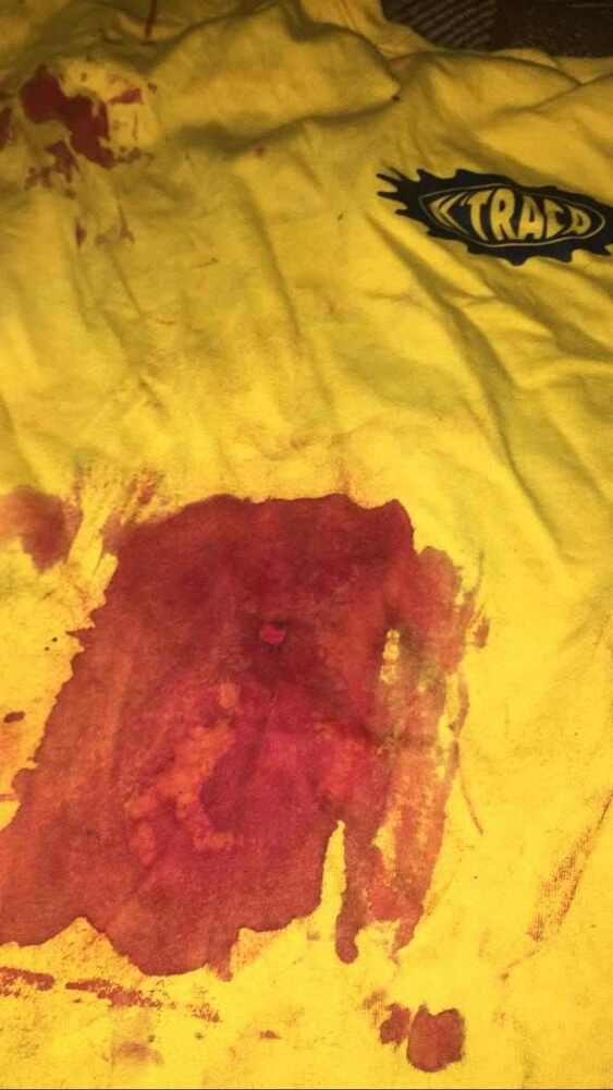 Roupa de jovem baleado nas costas por vigilante na estação Feira