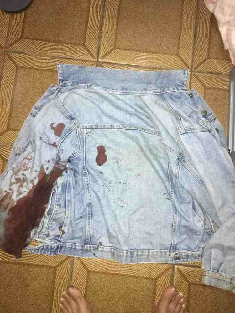 Roupa de jovem baleado nas costas por vigilante na estação Feira