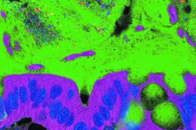 Bactérias em um intestino saudável: Sars-CoV-2 dificulta a produção de anticorpos no órgão - (crédito: Dr. Benoit Chassaing/Divulgação) Bactérias em um intestino saudável: Sars-CoV-2 dificulta a produção de anticorpos no órgão - (crédito: Dr. Benoit Chassaing/Divulgação)