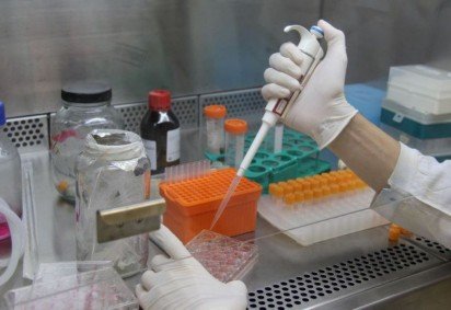 Pesquisadores desenvolvem testes rápidos para diagnóstico de covid-19 -  -Pesquisadores desenvolvem testes rápidos para diagnóstico de covid-19 - 