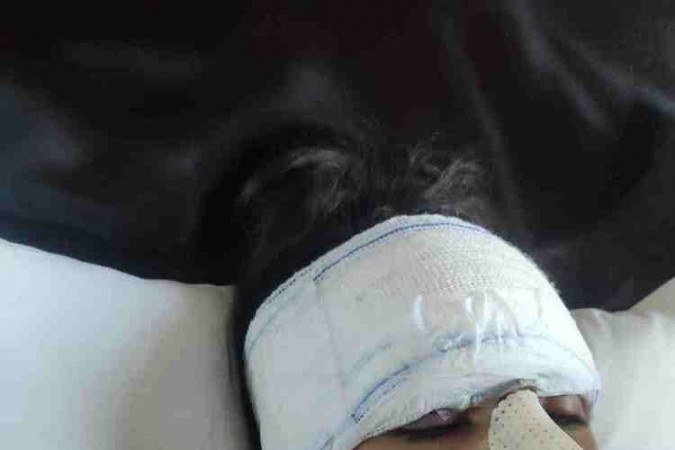 Momentos após a primeira cirurgia reparadora, feita em 10 de junho