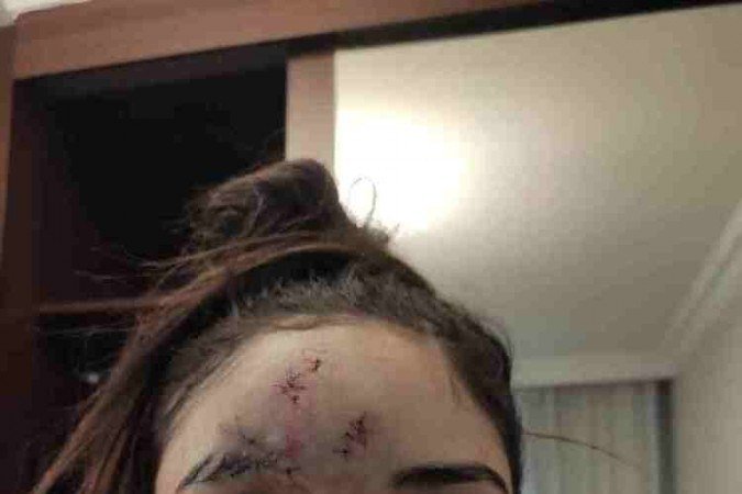 Felicidade estampada no rosto de Kedydja que afirma ter conseguido se ver no espelho novamente após sete meses