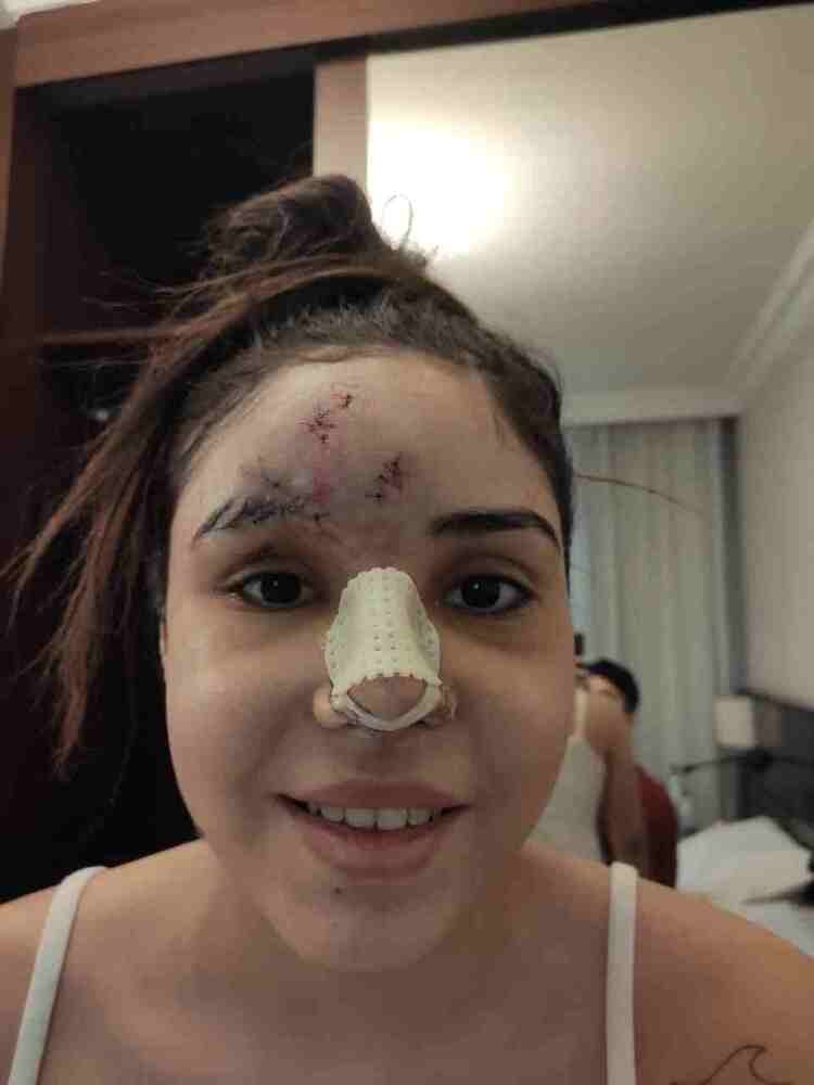 Felicidade estampada no rosto de Kedydja que afirma ter conseguido se ver no espelho novamente após sete meses