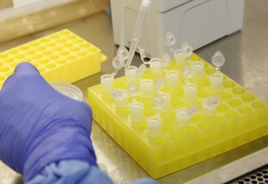 Divulgação/Josué Damacena (IOC/Fiocruz)