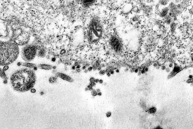  (crédito: Débora Barreto/Fiocruz)