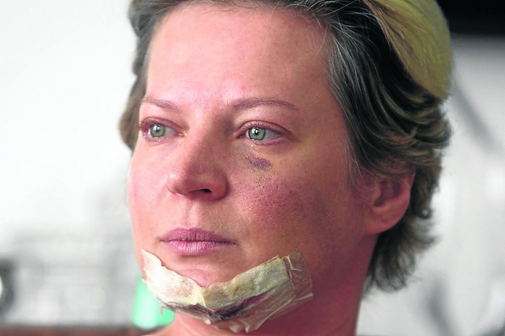 Polícia descarta agressão a Joice 