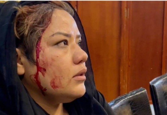 material cedido ao Correio