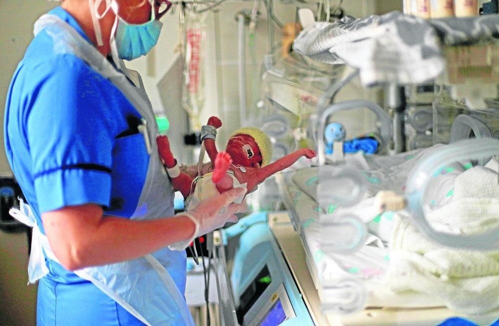 Cientistas apontam a necessidade de novos cuidados com os prematuros