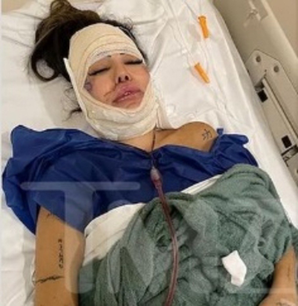 Liziane após cirurgia de recuperação em 2019