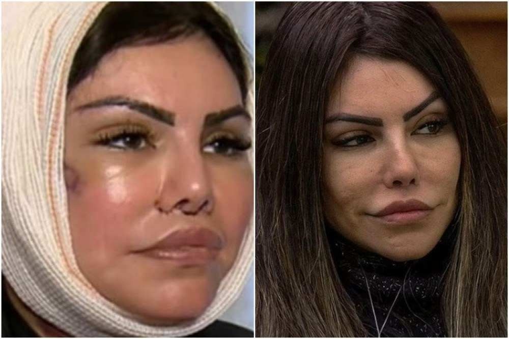 Liziane Gutierrez: antes e depois da modelo impressionam