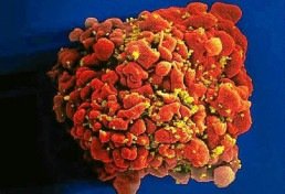 Gene em macacos e ratos tem potencial para bloquear os vírus do ebola e HIV