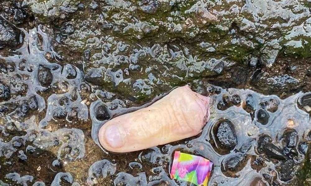 Cachorro encontra dedo humano na rua e polícia investiga o caso