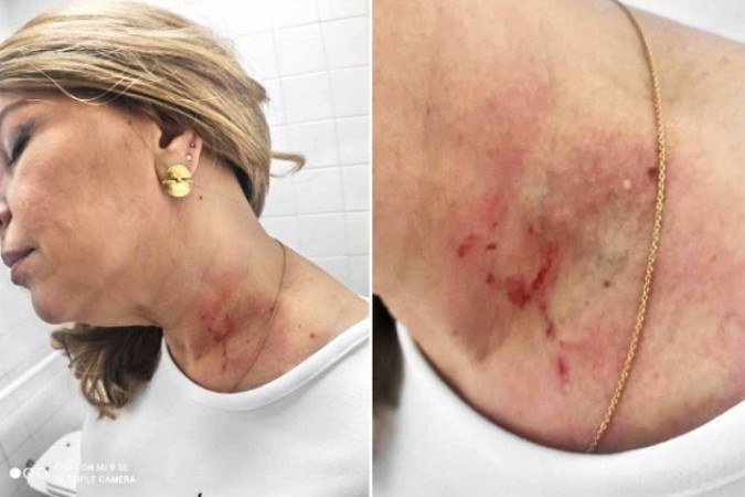 Cris Monteiro afirma que foi agredida por Janaína Lima, da mesma legenda - (crédito: Reprodução/Instagram/crismonteironovo) Cris Monteiro afirma que foi agredida por Janaína Lima, da mesma legenda - (crédito: Reprodução/Instagram/crismonteironovo)
