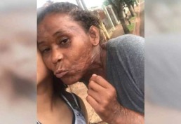 Mulher morre após ser atacada por 3 pitbulls na rua 